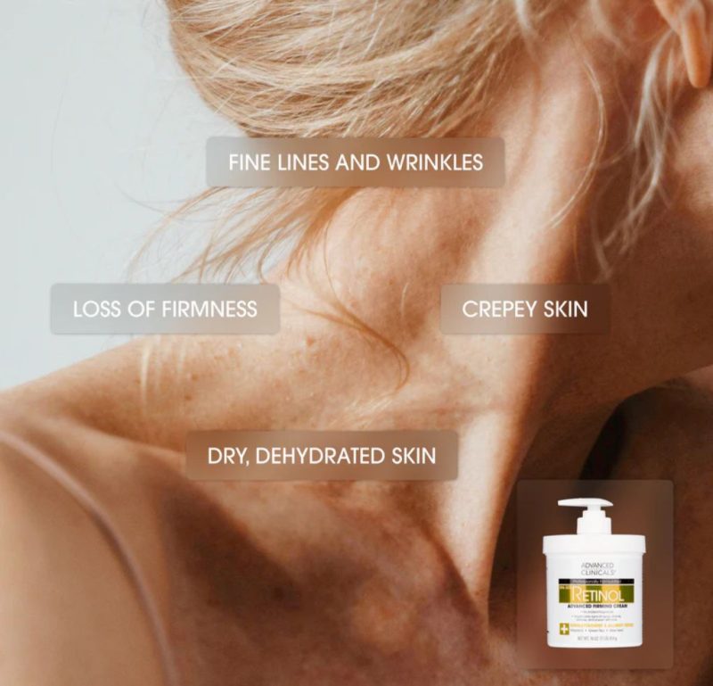 Advanced Clinicals Retinol Cream